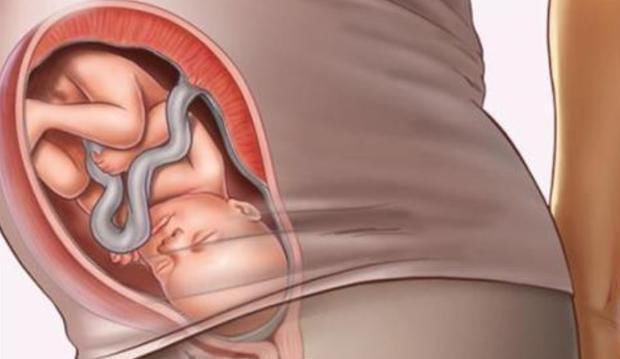 孕期|准妈妈记住“4不碰”，可以保持羊水“清澈”，让宝宝住得更舒心