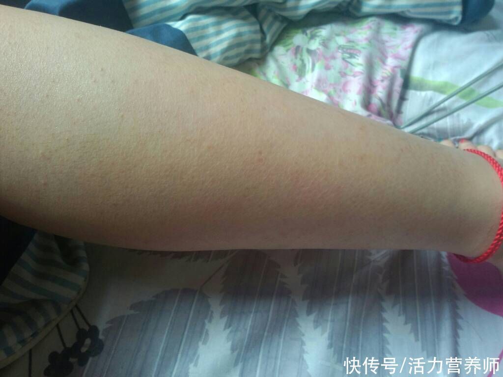 身体不适|为什么有些人汗毛是白的,还有些人是黑的?哪种视为正常现象?