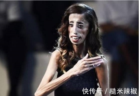 丽斯|她是世界上最瘦最丑的女人,体重不超过29公斤,却活出最美丽样子