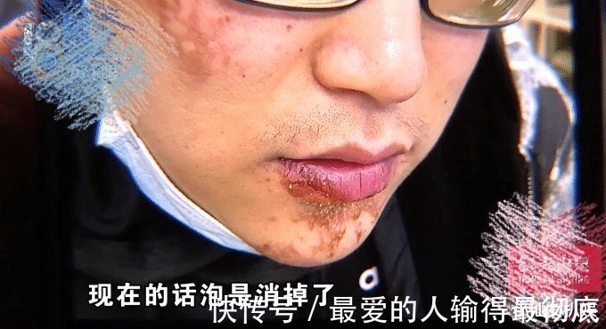 賢合莊|時(shí)隔1月，陳赫就“吃辣火鍋受傷”事件致歉，依舊眾怒難息：8萬(wàn)多么？