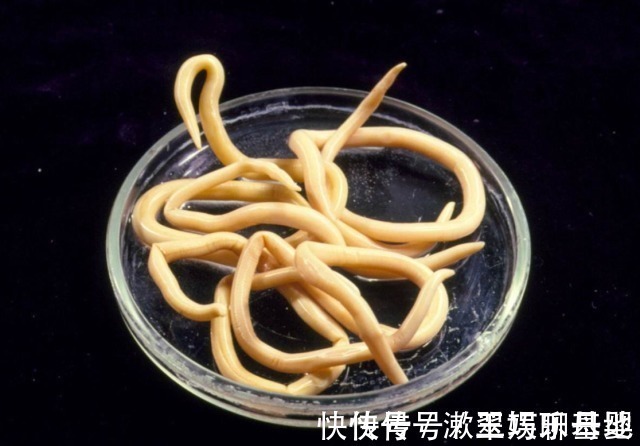 人体|孩子有这6大症状,表明肚子里长了“蛔虫”,家长们要重视起来!