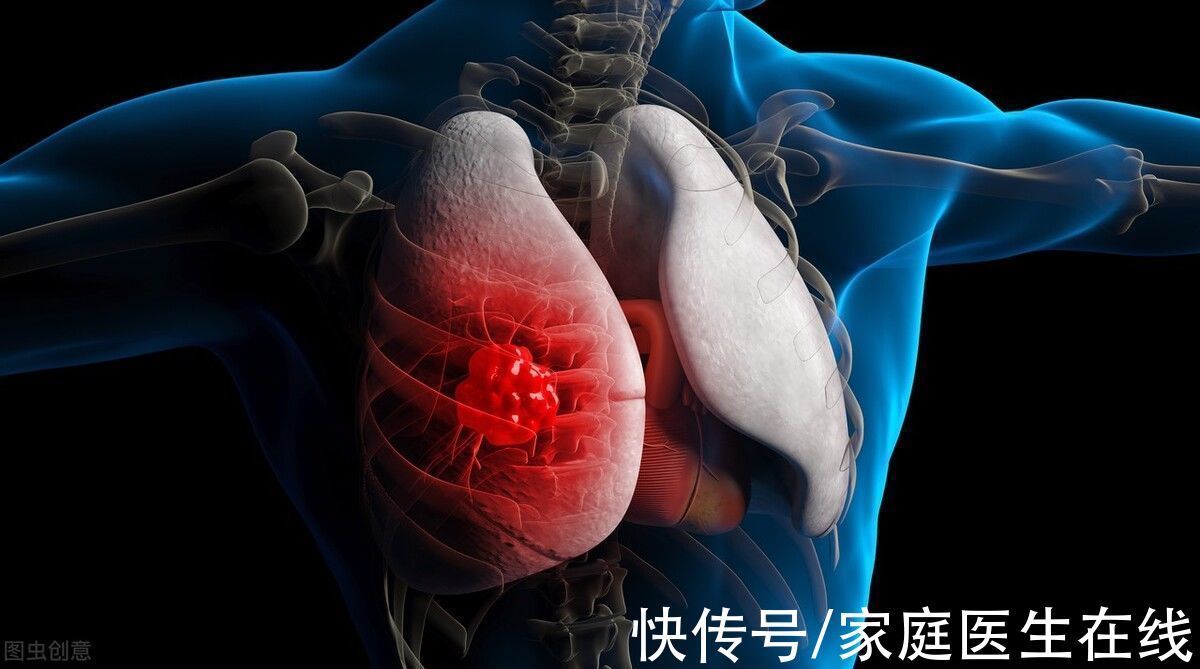 乳腺癌|癌症临床治愈后,有人复发有人不会是怎回事?疑惑很久的答案来了