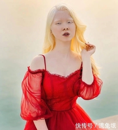 生而白首|一对罕见的“月亮姐妹”,被人嘲讽14年,拍完一组照片后惊艳众人