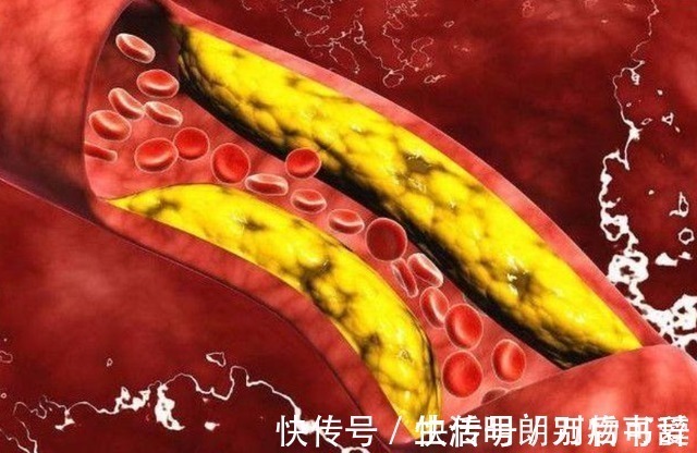 紫外线|长期喝茶的人与喝白开水的人相比,哪个更健康?不妨一起了解下