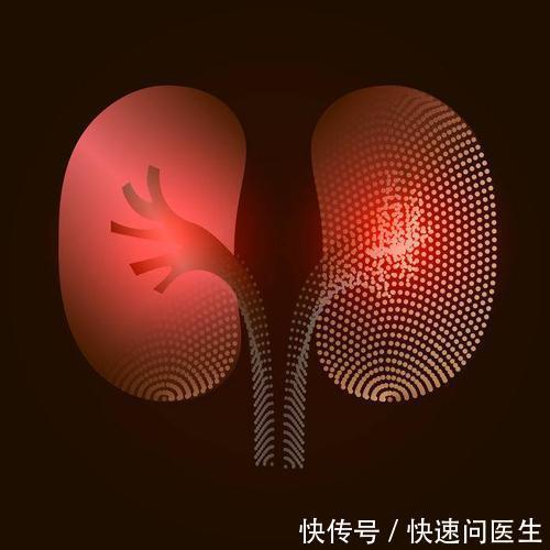 尿带泡沫就是蛋白尿?若是这几种,不代表身体健康出问题