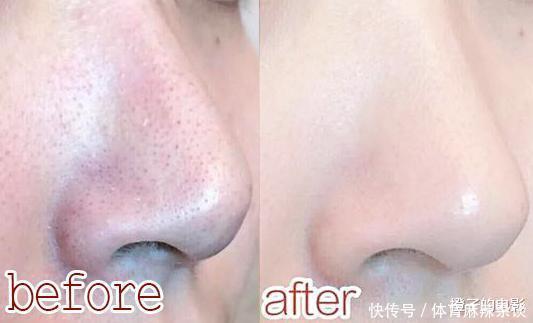 洗面奶|李佳琦直播5分钟,狂卖了20000支的洗面奶,网友7次黑头闭口没了