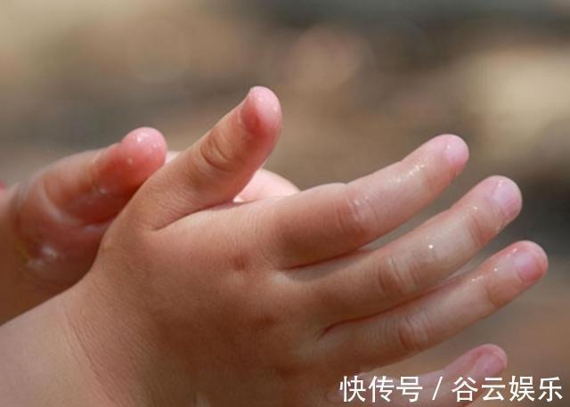 纱布|4岁儿子被开水烫伤,妈妈的“两个果断”救了娃,医生称赞做得对