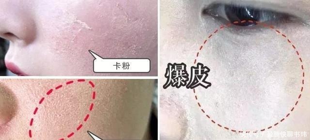 刷子 明星们丢弃“美妆蛋”改用“粉底刷”，化妆师透漏原因：太吃粉！