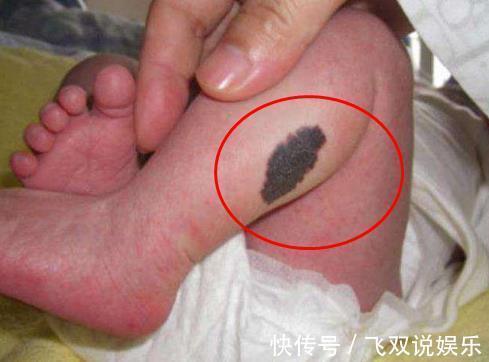 孕妈|怀孕后,几件事孕妈最好别做,容易在宝宝身上留下“胎记”!