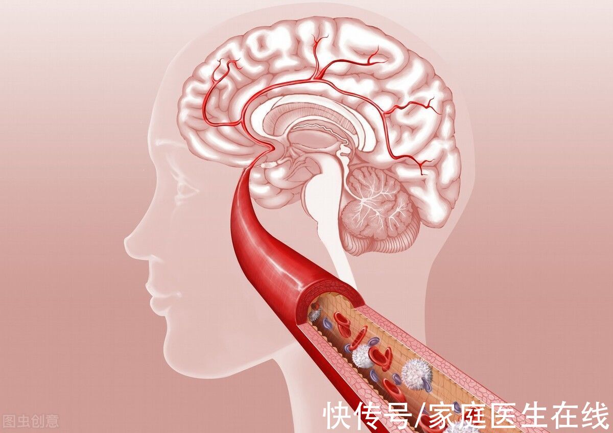 猝死率|人体最“堵不起”的5根血管？血管堵了，猝死率飙升