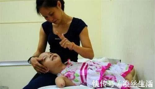 李女士|孕检发现孩子没有手脚，妈妈却坚持和医生说“生”，如今活成公主