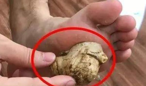 生姜|晚上睡覺前,把生姜涂抹在腳底下,堅(jiān)持15天,許多好處不請(qǐng)自來(lái)