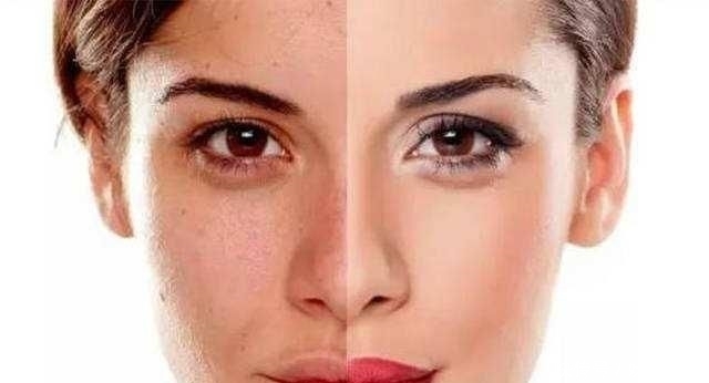 皮肤暗沉有斑点,试一试内调!这两样东西多吃点,不化妆也气色好