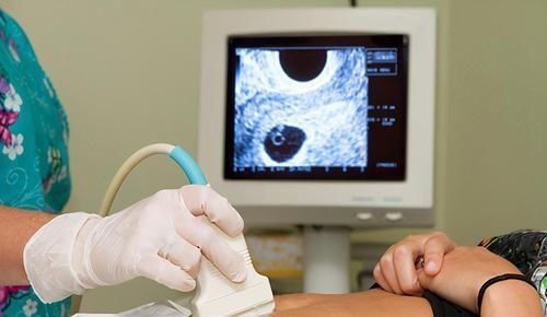 产检|怀孕后,要想有个健康宝宝,这10件事得上心,建议新手爸妈看看