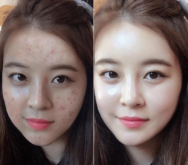 效果|女人逛超市碰到3种护肤品,建议多囤几瓶!虽然小众,但效果不错