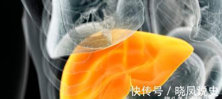 肝治|百病从肝治!灸5穴吃3宝,养肝、疏肝、护肝,肝“净”百病消!