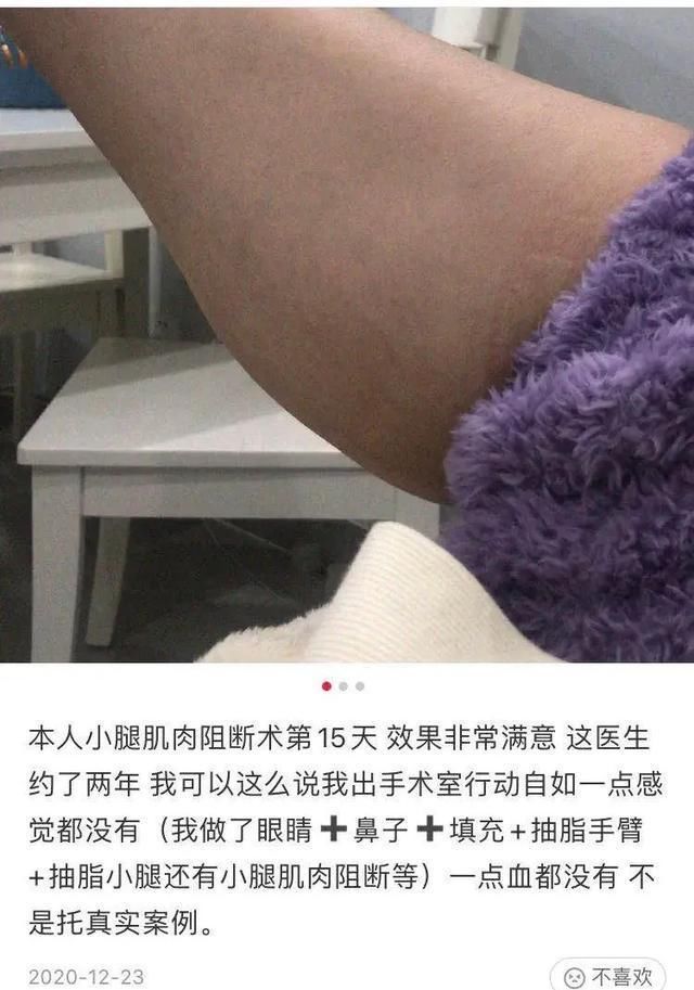 整容|医生，我耳朵不够精灵