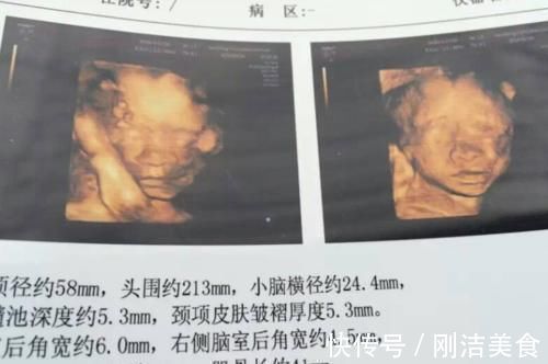 孕妈|孕妈看到胎宝“四维照”,表示娃不像自己,准爸爸:他也不像我!