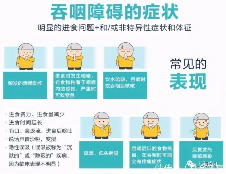  医生|吃饭和喝水时出现呛咳，松江医生提醒警惕这种疾病→