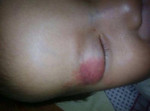 不想让宝宝有胎记？孕妈3种行为有关系，怀孕后不要太任性