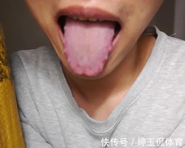 乾隆皇帝|脾虚的女人老得快!这个中医经典食疗方,专调脾胃,恢复好气色