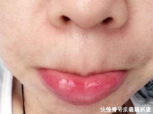 学生党“贼伤嘴巴”的3动作，多数00后已中招，变“火锅嘴”可别哭