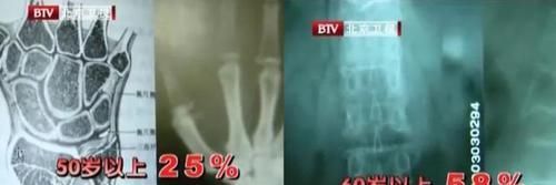  家人|补钙第一名竟是它！这份补钙排行榜，为了家人快收好，别乱吃了！