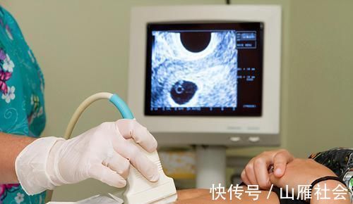 健康|怀孕后,要想有个健康宝宝,这10件事得上心,建议新手爸妈看看