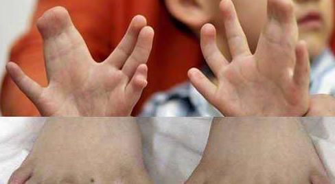 胎儿|“喜脉”到底是怎么摸出来的其实很容易,大家都可以自己试试看