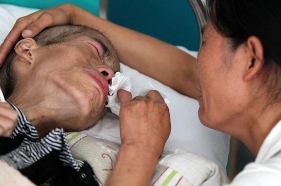 癌症|患上了癌症还能活多久 医生说 主要取决于这几点!