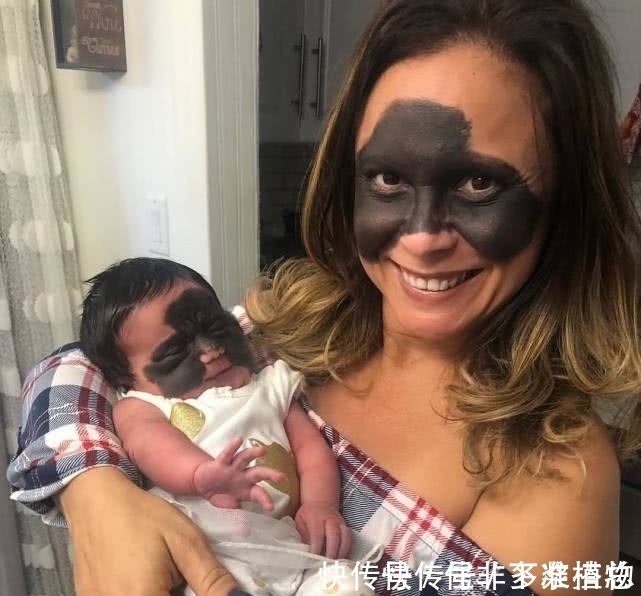 胎记|7个月婴儿脸上因巨大黑色胎记爆红！像带着“蝙蝠侠”面具！