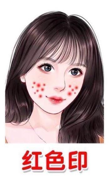 掌握6种痘印去除指南,不要“月球脸”,轻松养成“牛奶肌”