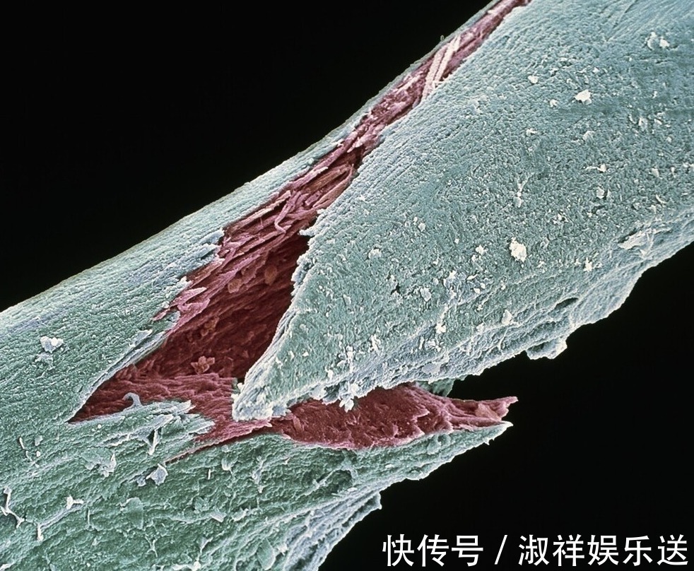 中老年人|骨质疏松不能吃鸡蛋骨科医生要想骨骼健康，2种食物别太贪吃