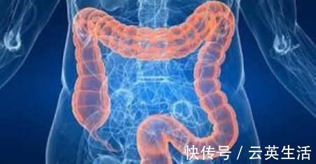 肠道|便秘的“克星”来了, 每天吃两口, 快速通便, 肠道越吃越通畅!