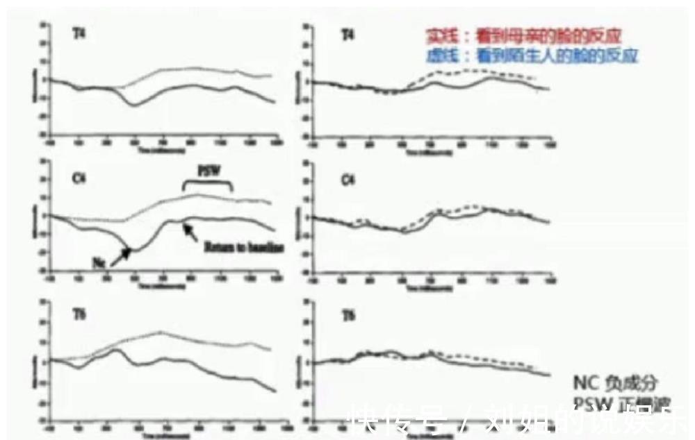 危险因素|影响胎儿“脑发育”的4个因素，一定要注意了！