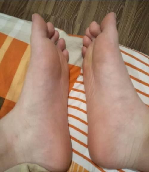 肝脏是否健康脚知道，脚部4种现象在提醒你，该好好保护你的脚了