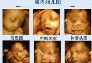 打嗝|怀孕10月280天,胎宝宝都是怎样打发时间的他们在子宫里嗨着呢