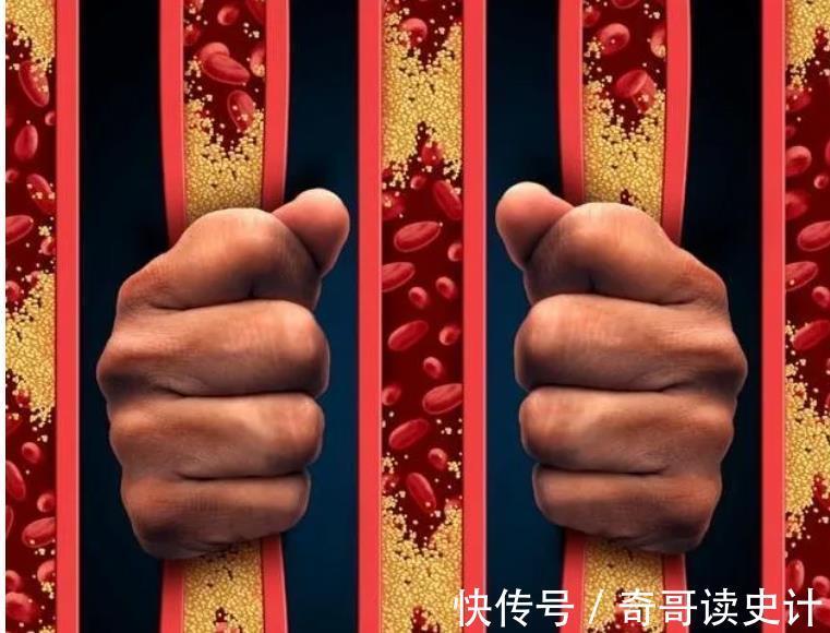 血脂|高血脂“帮凶”已找到,脸上有这3异常,多半血脂已超标,早就医