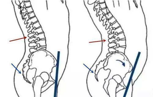 臀部|怎么练出翘臀？与基因有关吗？练翘臀先了解这3个因素！