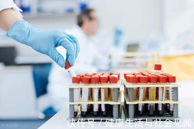 骨髓腔|血常规能发现白血病吗?其实,这种检查才是确诊白血病的金标准