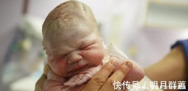 产妇|剖腹产生宝宝时要让产妇亲吻宝宝？别小看这个环节，有这四个意义