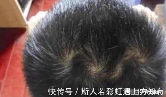 宝宝|宝贝头上的“头旋”个数代表啥？可能很多宝妈还不清楚