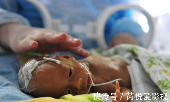 龙凤胎|孕妇生下龙凤胎只能保一个,婆婆的决定,孕妇表示赞同