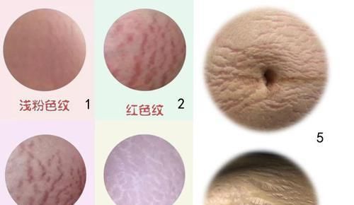 妈妈|四胞胎妈妈身材“太好”走红网络，她掀起衣服后，网友都捂住了嘴