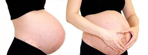 五个月|为什么很多孕妈怀孕四五个月了,还不显怀?三个原因告诉你