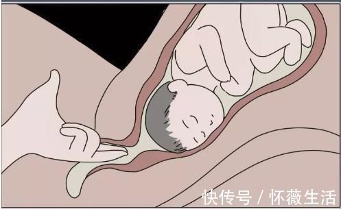 辣妈学院|顺产“开十指”是怎么开的一组过程图让你明白什么叫为母则刚