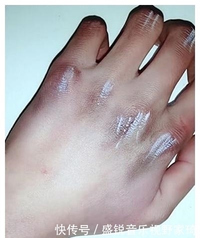 伤口|画“伤口”,开头觉得在瞎画,看到结局:老师必须准假