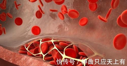 溶栓|“溶栓高手”公布,并非苦瓜,平时敞开吃,血管干净,远离头晕手麻