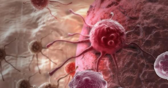 口腔疾病|早上起床时,没有4个表现,那就恭喜你,没有被癌细胞“看中”!