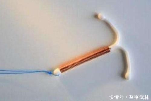 节育环|很多女性“上环”后很后悔,为何?原来对身体有五个危害,望重视